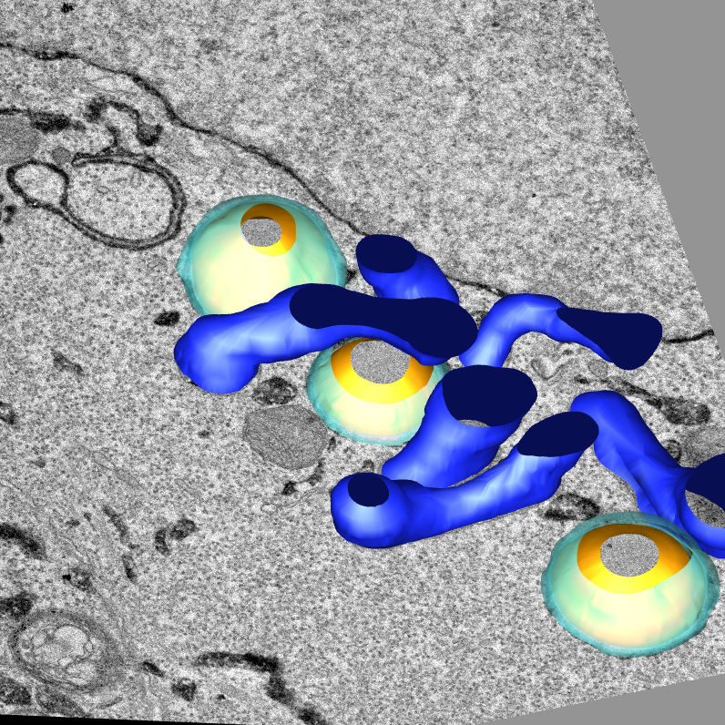 Electron Microscopy – Institute for Integrative Biology of the Cell