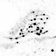 CG_20221013_Hei10GFP_Airyscan-Processing_MAX_19-22_T1_INVERTED: Super-resolution fluorescence micrograph of a Sordaria macrospora meiocyte expressing HEI10–eGFP.