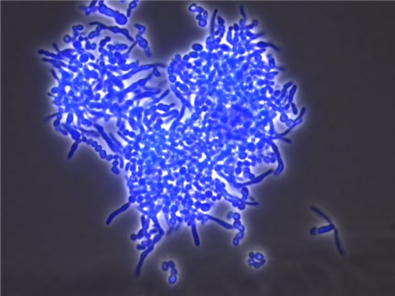 streptomyces-venezuelae